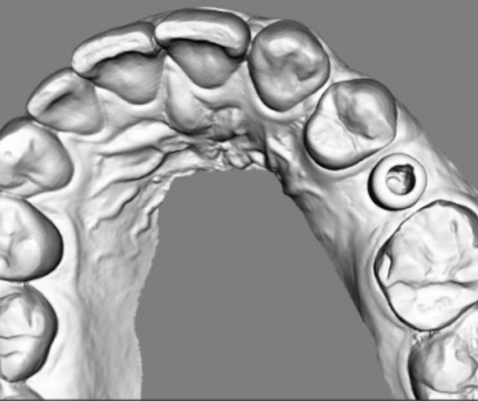 12880_3 Case Report Neoss ProActive Edge Dr van Thoor EN letter PRINT INT