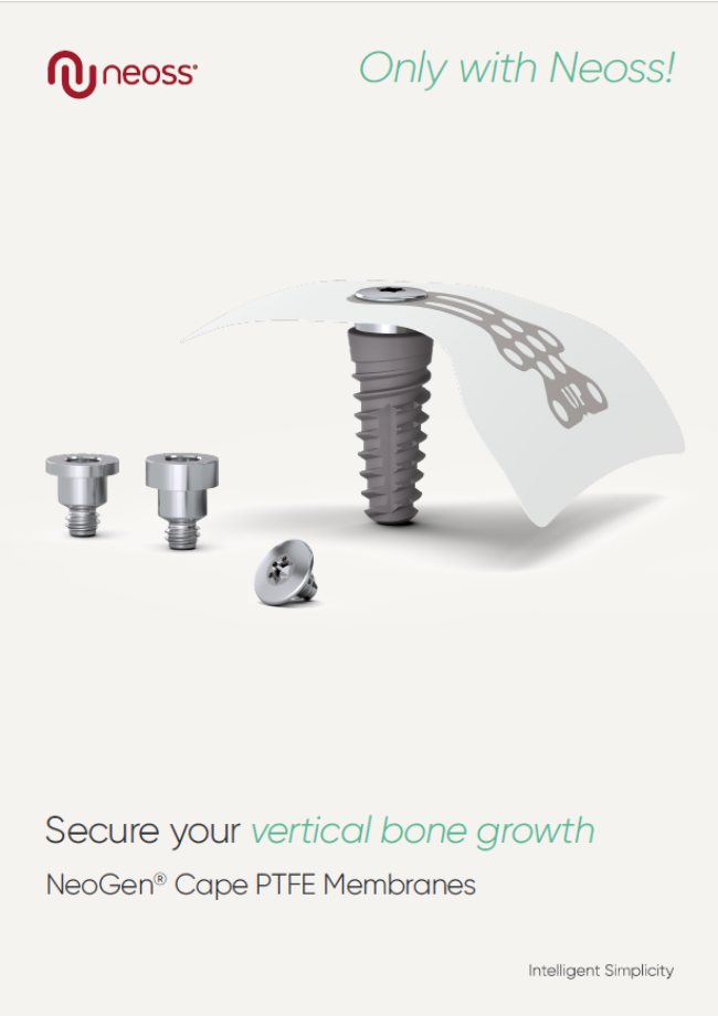 NeoGen Cape PTFE Membranes