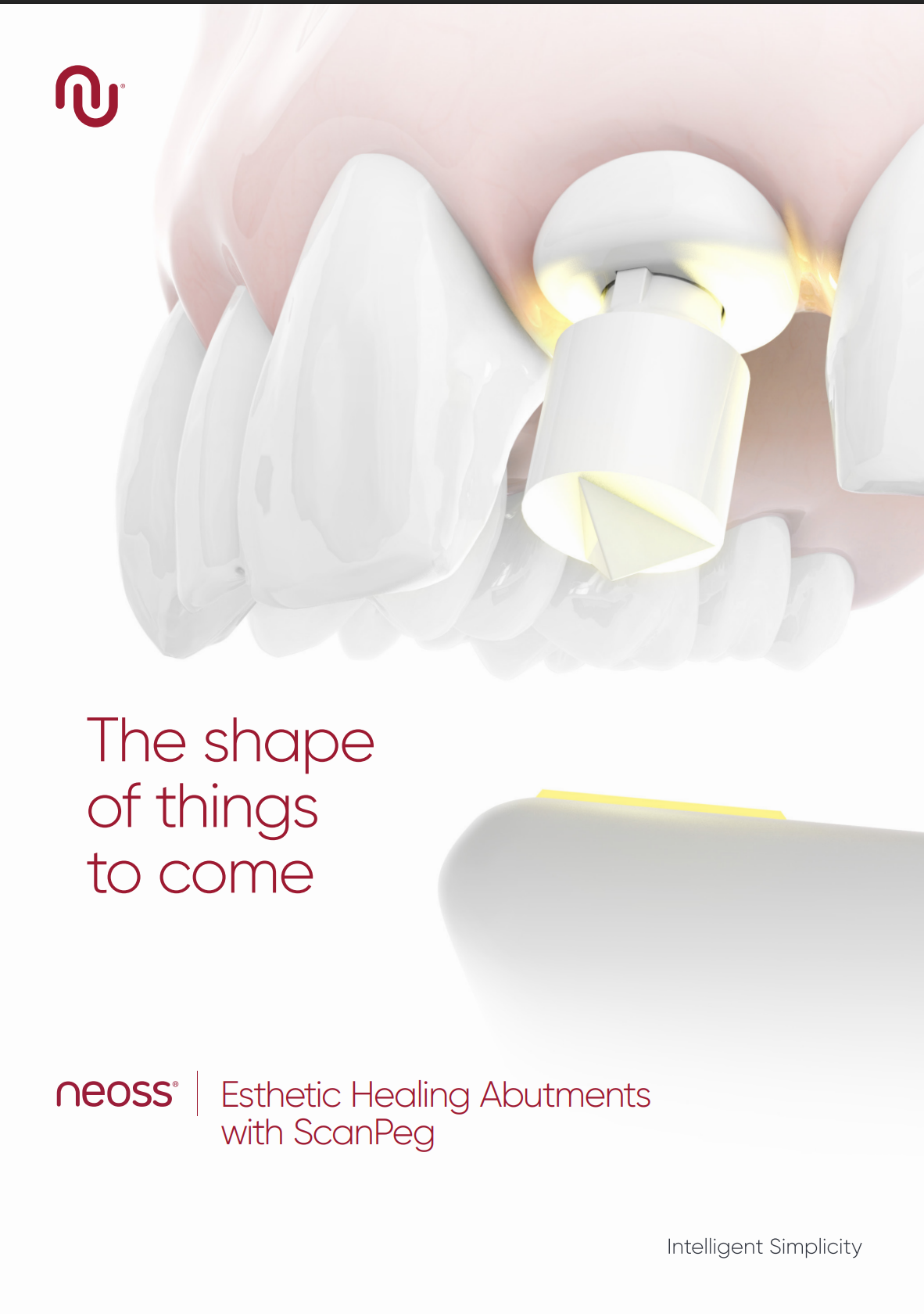 The shape of things to come – Esthetic Healing Abutments with ScanPeg