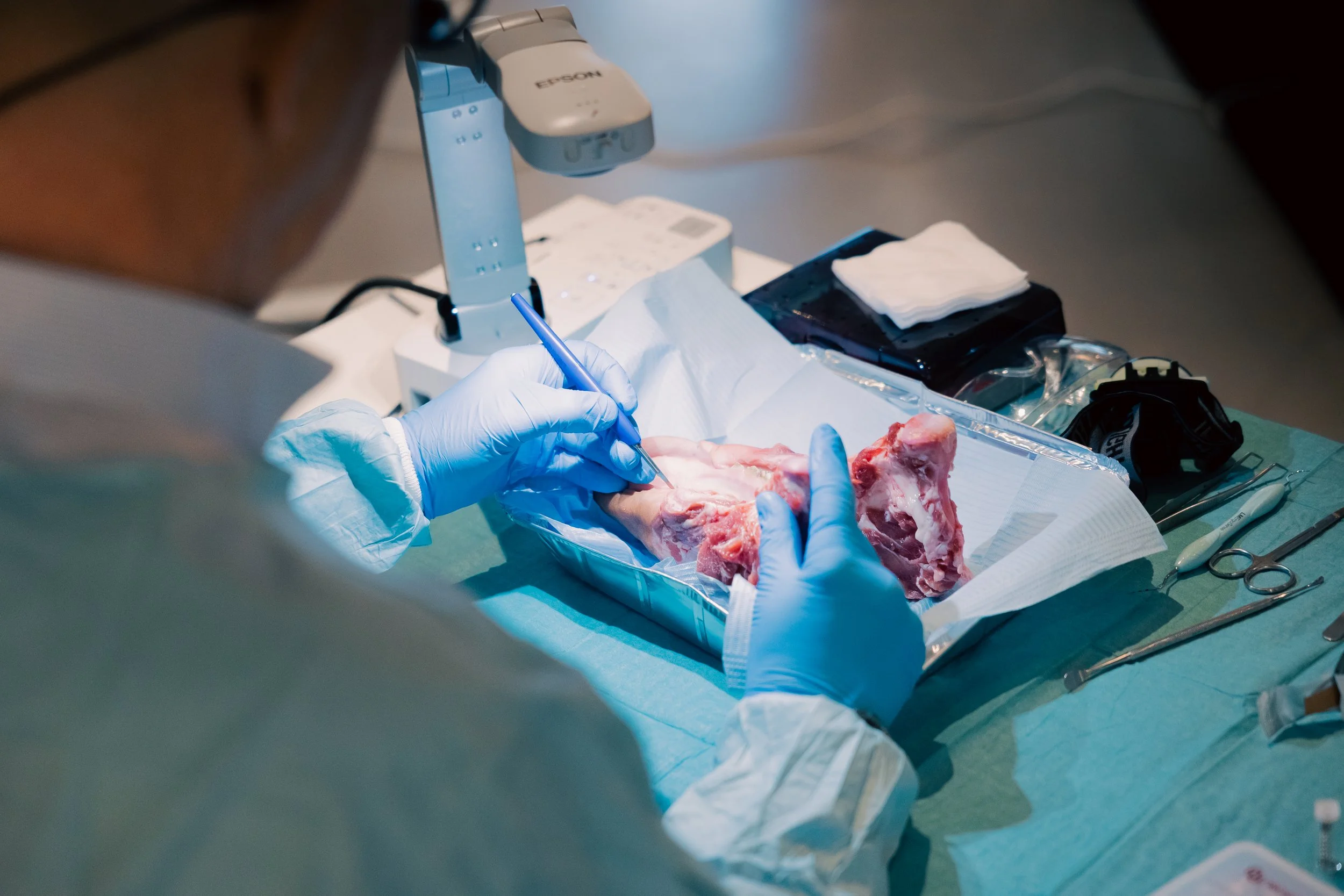 Benuppbyggnad steg 1