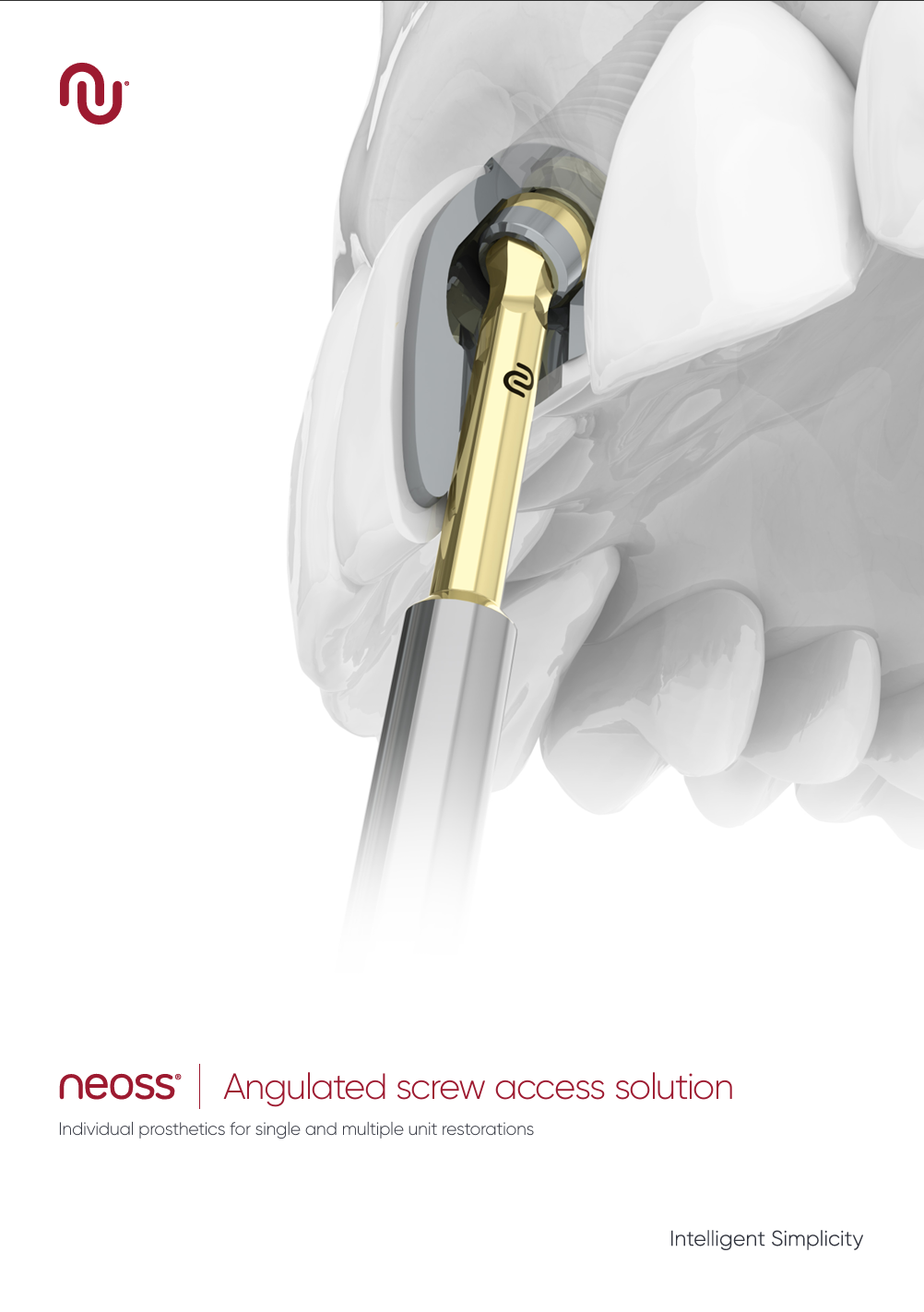 Brochure Angulated screw access solution EN 2018-09-28